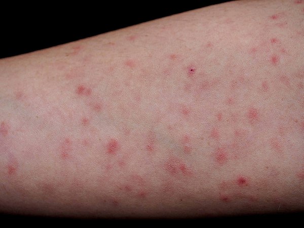 Skin Pathology diagnosis and treatment